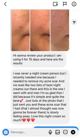 HAVELYN Body Whitening Bundle